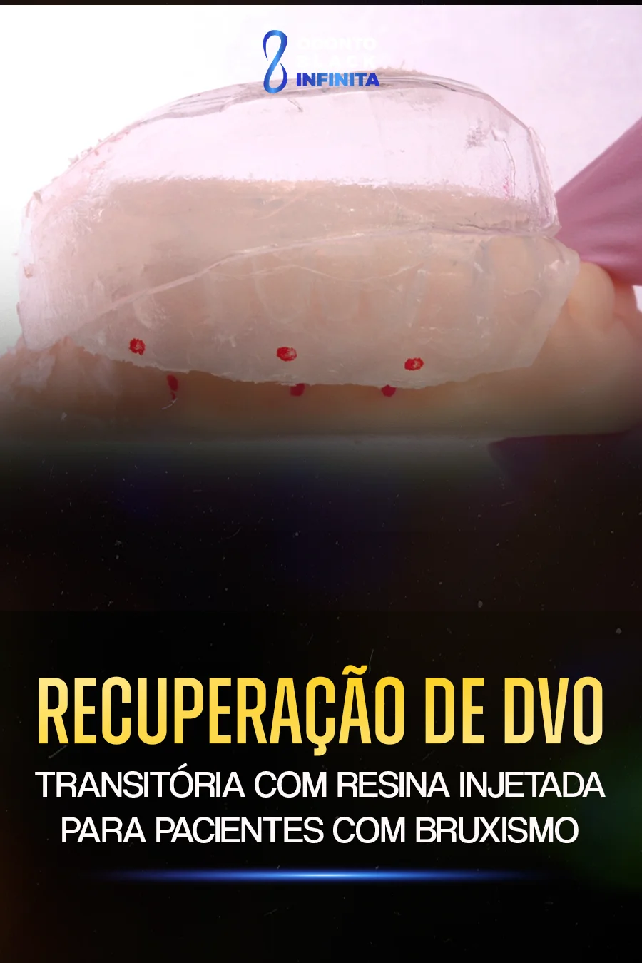 DVO